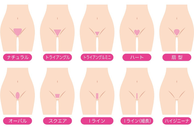 客受けの良いアンダーヘアの形