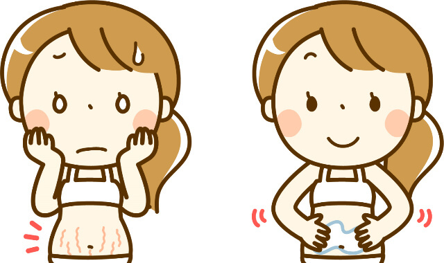 妊娠線、肉割れのケアをしている画像
